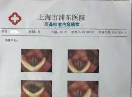 声音嘶哑小半年了，做了个喉镜，请懂的指教一下
