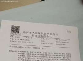 肺鳞癌骨转移