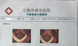 声音嘶哑小半年了，做了个喉镜，请懂的指教一下