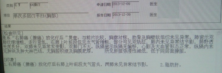 胸部CT平扫1209