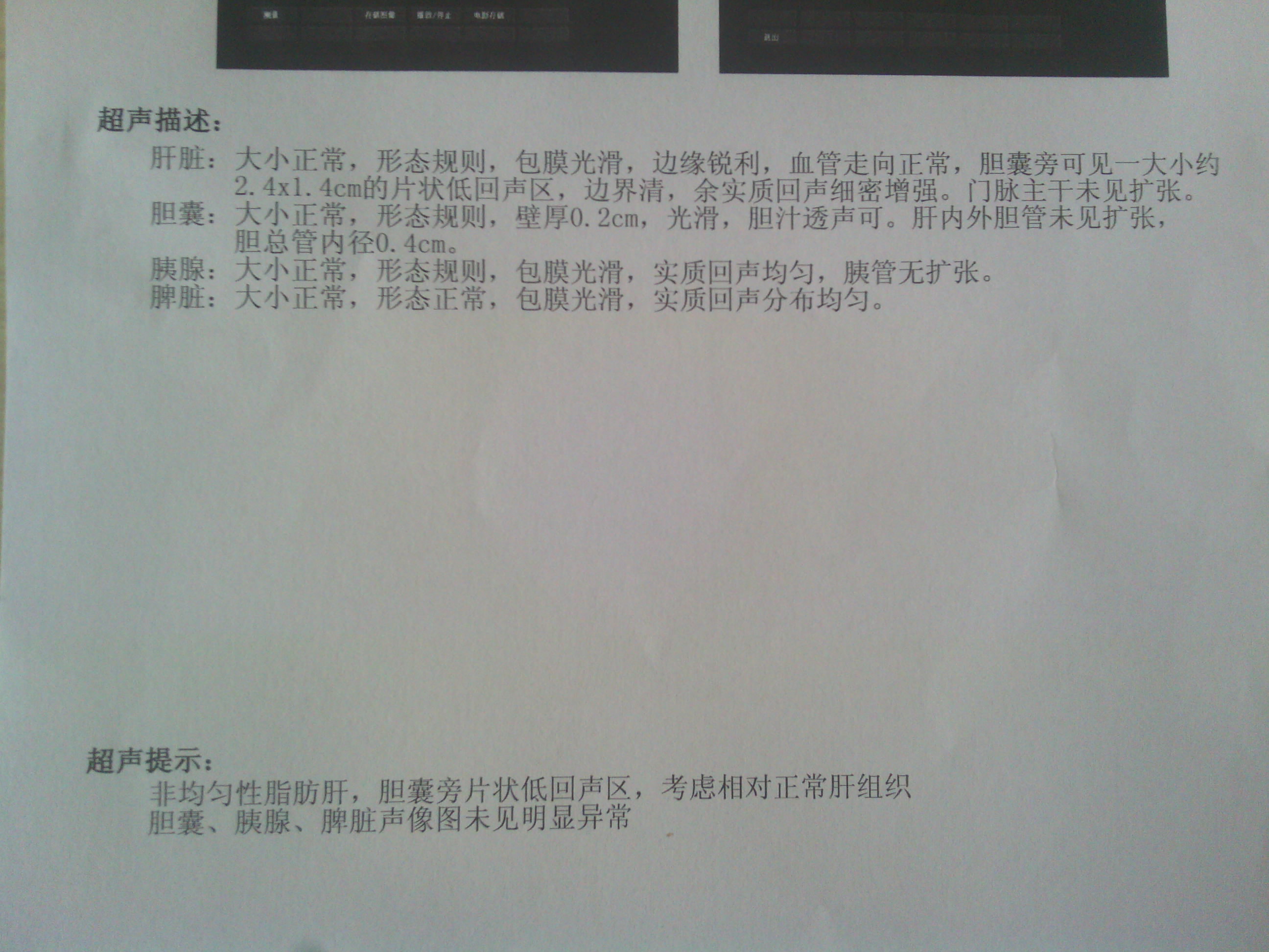 腹部彩超20140301.jpg