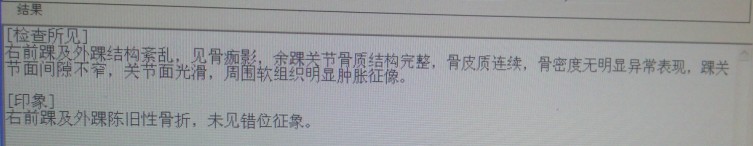 20140228脚踝X光片子