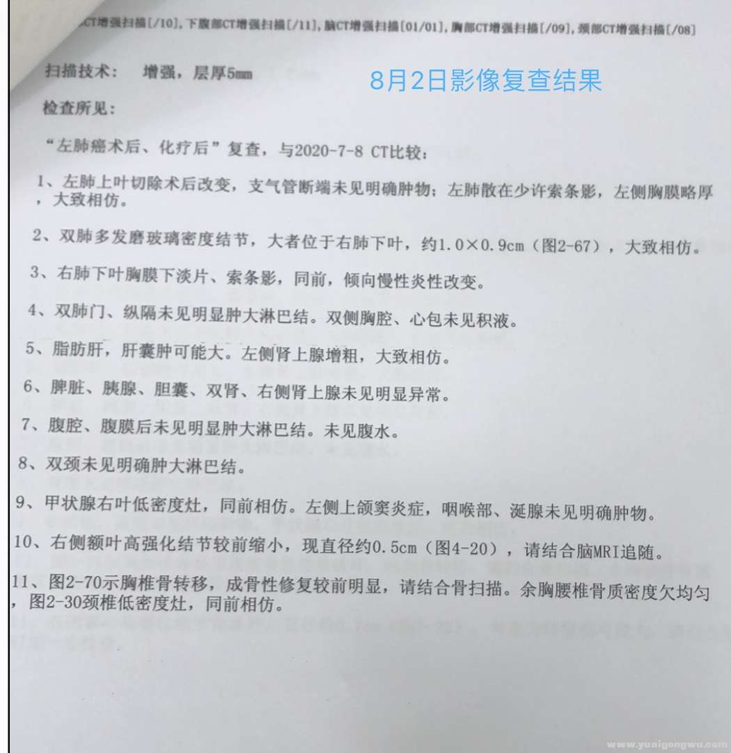 8月凯美纳一个月后影像结果